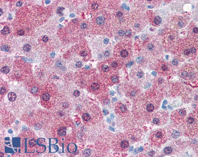 GCNT3 Antibody - Anti-GCNT3 antibody IHC of human liver. Immunohistochemistry of formalin-fixed, paraffin-embedded tissue after heat-induced antigen retrieval.