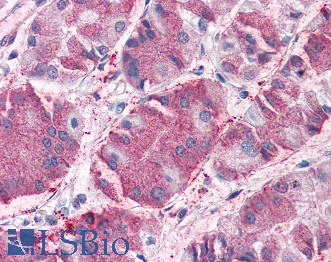 GCNT3 Antibody - Anti-GCNT3 antibody IHC of human stomach. Immunohistochemistry of formalin-fixed, paraffin-embedded tissue after heat-induced antigen retrieval.