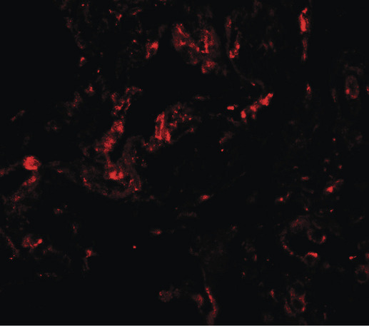 GDF1 Antibody - Immunofluorescence of GDF1 in human lung tissue with GDF1 antibody at 20 ug/ml.