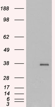 GDF15 Antibody - HEK293 overexpressing GDF15 (RC201295) and probed with (mock transfection in first lane).