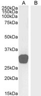 GDF15 Antibody - Goat Anti-GDF15 Antibody (0.3µg/ml) staining of Human Testes (A) and negative control Skin (B) lysate (35µg protein in RIPA buffer). Detected by chemiluminescencence.