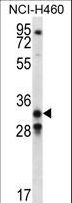 GDF15 Antibody - GDF15 Antibody western blot of NCI-H460 cell line lysates (35 ug/lane). The GDF15 antibody detected the GDF15 protein (arrow).