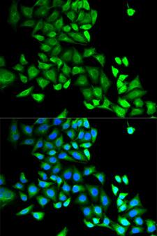 GDI1 Antibody - Immunofluorescence analysis of MCF-7 cell using GDI1 antibody. Blue: DAPI for nuclear staining.