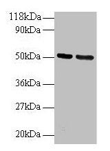 GDI2 Antibody - Western blot Lane 1: 293T whole cell lysate Lane 2: EC109 whole cell lysate Secondary Goat polyclonal to rabbit IgG at 1/15000 dilution Predicted band size: 51, 46 kDa Observed band size: 51, 35, 40, 55, 80 kDa