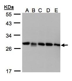 GDI2 Antibody - Sample(30g whole cell lysate). A: 293T. B: A431. C: H1299. D: HeLa S3. E: Hep G2. 12% SDS PAGE. GDI2 antibody diluted at 1:1000