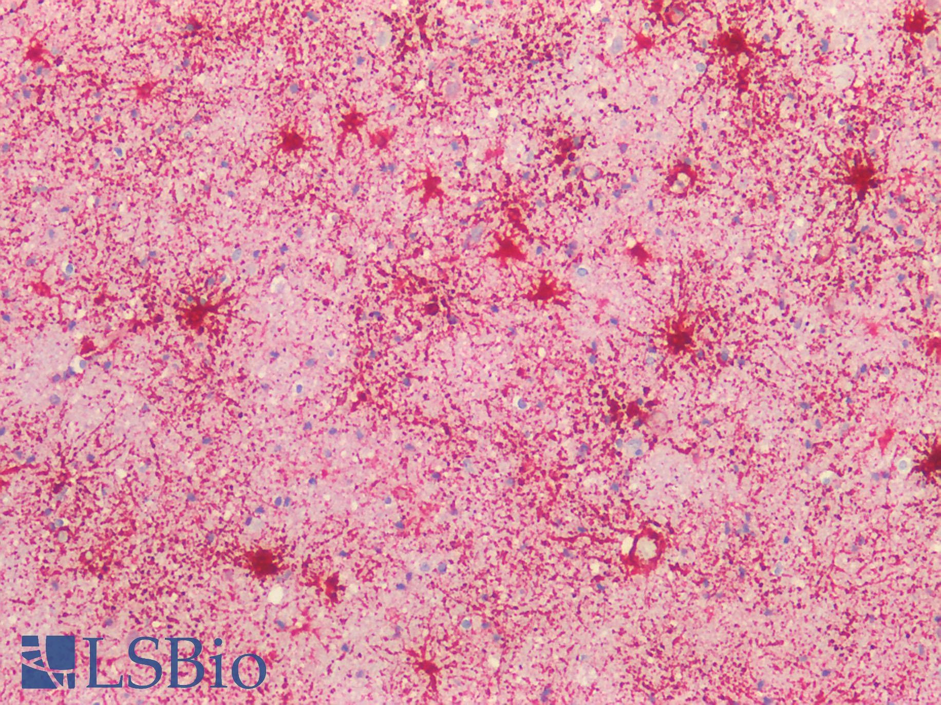GFAP Antibody - Human Brain, Cortex: Formalin-Fixed, Paraffin-Embedded (FFPE) HIER using 10 mM sodium citrate buffer pH 6.0