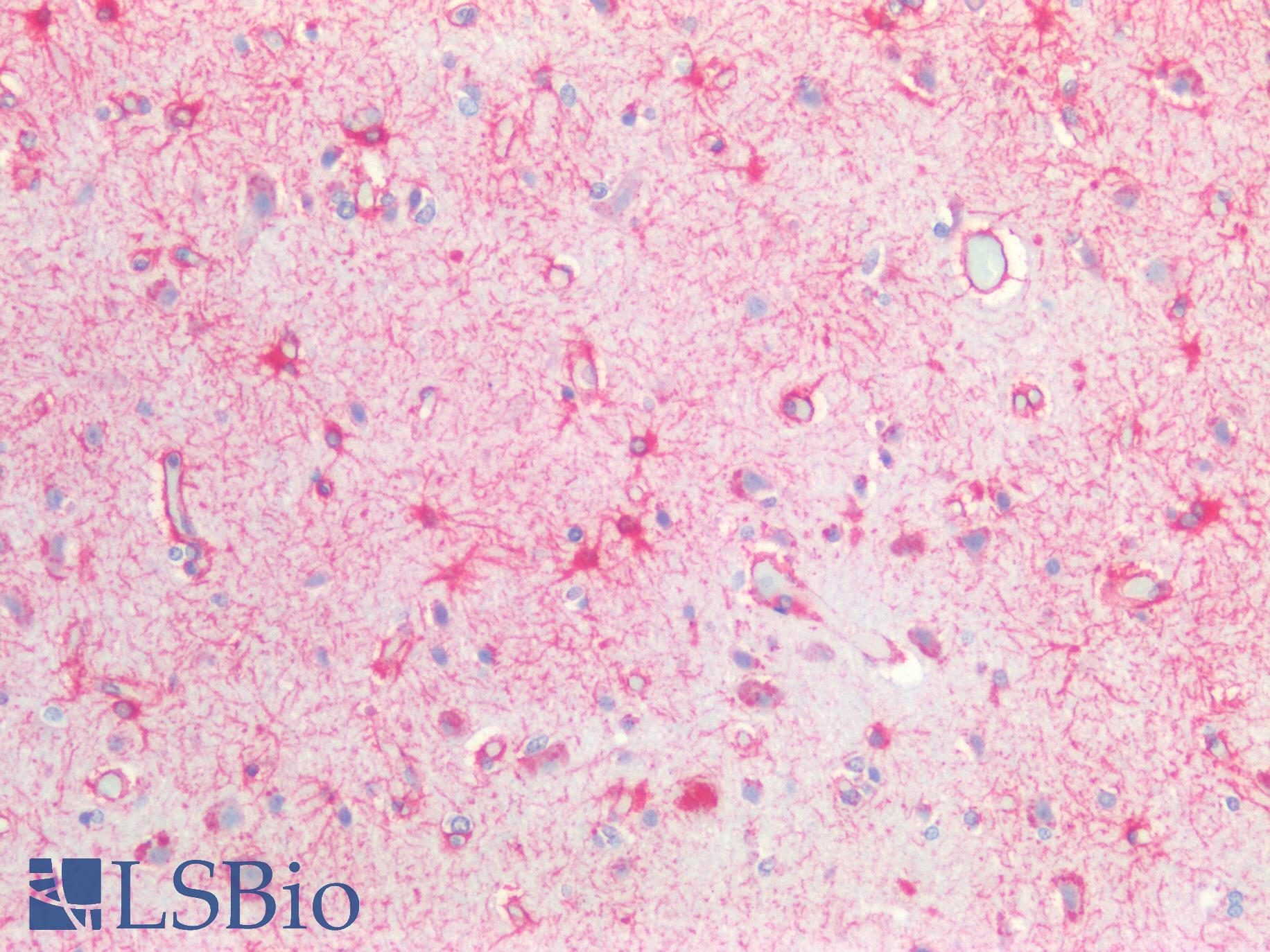 GFAP Antibody - Human Brain, Cortex: Formalin-Fixed, Paraffin-Embedded (FFPE)