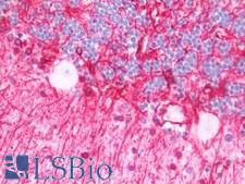 GFAP Antibody - Human Brain, Cerebellum: Formalin-Fixed, Paraffin-Embedded (FFPE) 