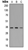 GFI1B Antibody - Western blot analysis of GFI1B expression in HEK293T (A); NS-1 (B); H9C2 (C) whole cell lysates.