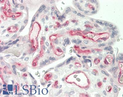 GFI1B Antibody - Human Placenta: Formalin-Fixed, Paraffin-Embedded (FFPE)