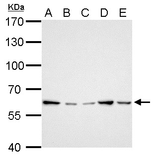GGT1 / GGT Antibody - GGT1 antibody detects GGT1 protein by Western blot analysis. A. 30 ug Neuro2A whole cell lysate/extract. B. 30 ug GL261 whole cell lysate/extract. C. 30 ug C8D30 whole cell lysate/extract. D. 30 ug NIH-3T3 whole cell lysate/extract. E. 30 ug Raw264.7 whole cell lysate/extract. F. 30 ug C2C12 whole cell lysate/extract. 7.5 % SDS-PAGE. GGT1 antibody dilution:1:1000.