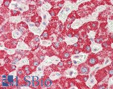 GGT1 / GGT Antibody - Anti-GGT1 / GGT antibody IHC staining of human liver. Immunohistochemistry of formalin-fixed, paraffin-embedded tissue after heat-induced antigen retrieval. Antibody concentration 5 ug/ml.