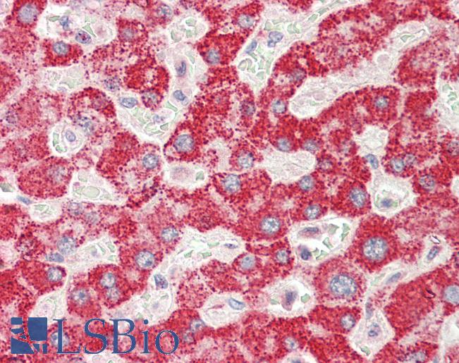 GGT1 / GGT Antibody - Anti-GGT1 / GGT antibody IHC staining of human liver. Immunohistochemistry of formalin-fixed, paraffin-embedded tissue after heat-induced antigen retrieval. Antibody concentration 5 ug/ml.