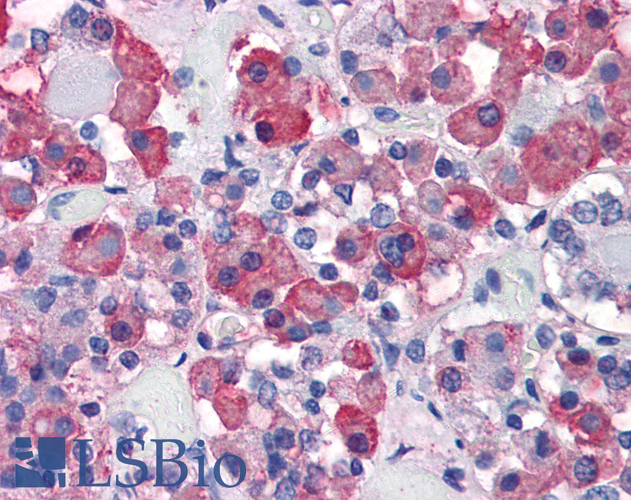 GH / Growth Hormone Antibody - Anti-Growth Hormone antibody IHC of human anterior pituitary. Immunohistochemistry of formalin-fixed, paraffin-embedded tissue after heat-induced antigen retrieval. Antibody concentration 10 ug/ml.