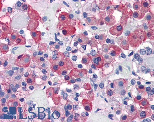 GH / Growth Hormone Antibody - Anti-Growth Hormone antibody IHC of human anterior pituitary. Immunohistochemistry of formalin-fixed, paraffin-embedded tissue after heat-induced antigen retrieval. Antibody concentration 10 ug/ml.