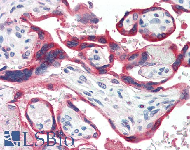 GH / Growth Hormone Antibody - Anti-Growth Hormone antibody IHC of human placenta. Immunohistochemistry of formalin-fixed, paraffin-embedded tissue after heat-induced antigen retrieval. Antibody dilution of 1:200.