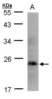 GH / Growth Hormone Antibody - Sample(30 ug whole cell lysate). A:293T. 12% SDS PAGE. GH1 antibody diluted at 1:1000