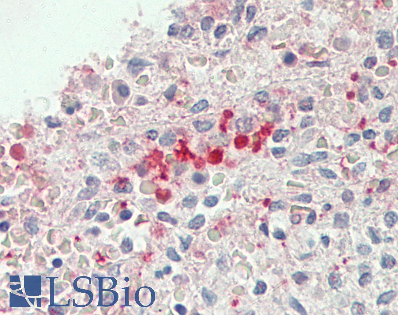 GHBP / BLVRB Antibody - Anti-GHBP / BLVRB antibody IHC staining of human spleen, erythrocytes. Immunohistochemistry of formalin-fixed, paraffin-embedded tissue after heat-induced antigen retrieval.