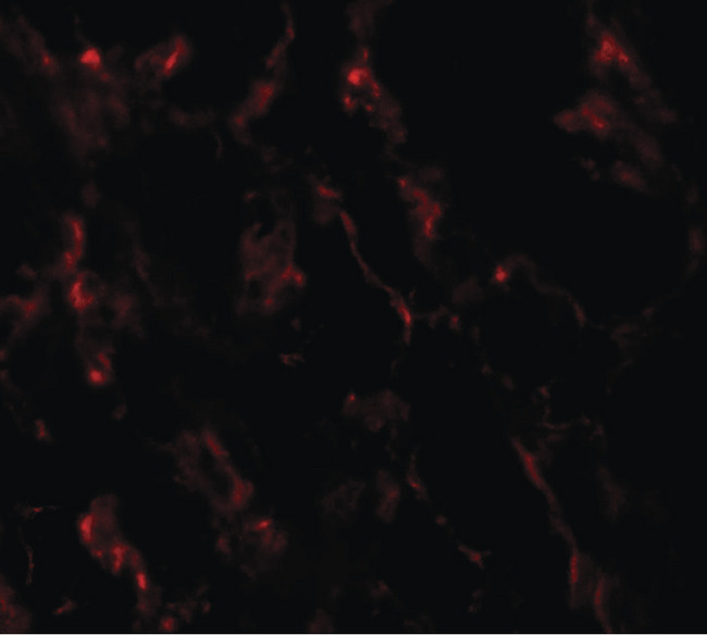 GHDC Antibody - Immunofluorescence of GHDC1 in human breast tissue with GHDC1 antibody at 20 ug/ml.
