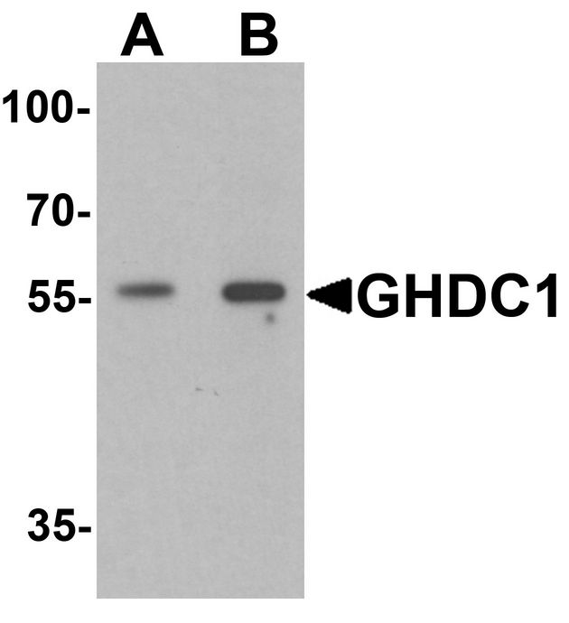 GHDC Antibody - Western blot analysis of GHDC in 293 cell lysate with GHDC antibody at (A) 0.5 and (B) 1 ug/ml.