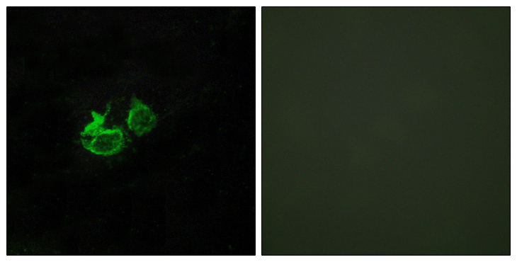 GHRHR Antibody - Immunofluorescence analysis of HUVEC cells, using GHRHR Antibody. The picture on the right is blocked with the synthesized peptide.