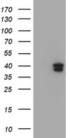 GIMAP4 Antibody - HEK293T cells were transfected with the pCMV6-ENTRY control (Left lane) or pCMV6-ENTRY GIMAP4 (Right lane) cDNA for 48 hrs and lysed. Equivalent amounts of cell lysates (5 ug per lane) were separated by SDS-PAGE and immunoblotted with anti-GIMAP4.