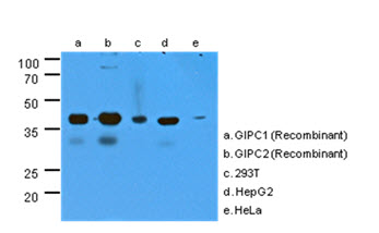 GIPC1 / GIPC Antibody - Western Blot: The cell lysates (40 ug) were resolved by SDS-PAGE, transferred to PVDF membrane and probed with anti-human GIPC antibody (1:1000). Proteins were visualized using a goat anti-mouse secondary antibody conjugated to HRP and an ECL detection system. The cross-reacting of anti-human GIPC (AT1G10) were analyzed by using recombinant protein(20ng) of GIPC1 and GIPC2.