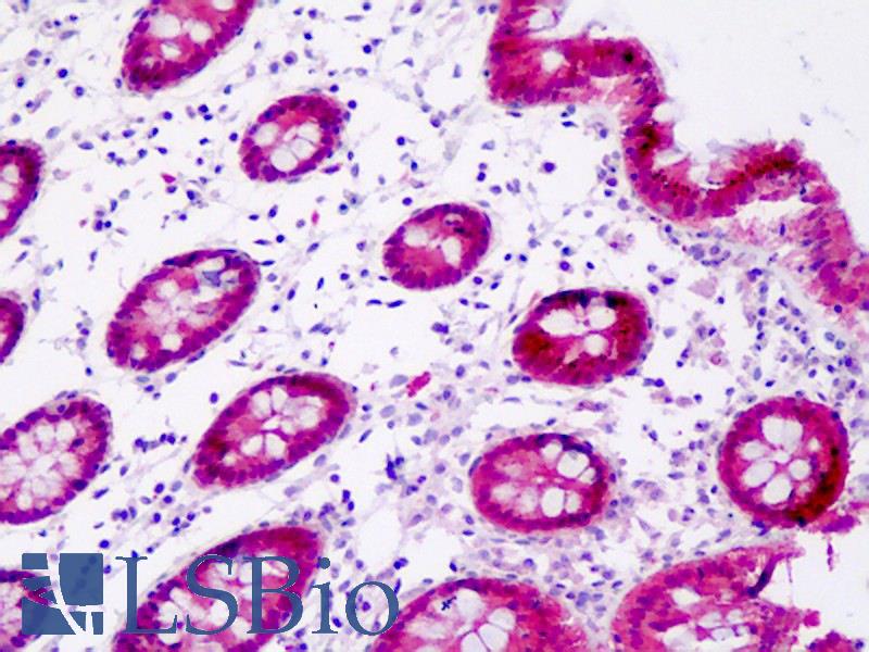 GIPC1 / GIPC Antibody - Anti-GIPC1 / GIPC antibody IHC staining of human colon. Immunohistochemistry of formalin-fixed, paraffin-embedded tissue after heat-induced antigen retrieval.