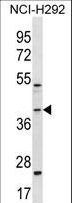 GIPC2 Antibody - GIPC2 Antibody western blot of NCI-H292 cell line lysates (35 ug/lane). The GIPC2 antibody detected the GIPC2 protein (arrow).