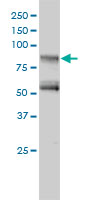 GIT2 Antibody - GIT2 monoclonal antibody, clone 3B5-B9 Western blot of GIT2 expression in Jurkat.