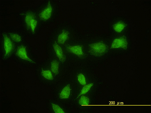 GIT2 Antibody - Immunofluorescence of monoclonal antibody to GIT2 on HeLa cell. [antibody concentration 20 ug/ml]