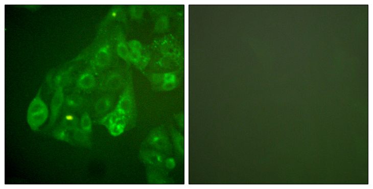 GJA1 / CX43 / Connexin 43 Antibody - Immunofluorescence analysis of A549 cells, using Connexin 43 Antibody. The picture on the right is blocked with the synthesized peptide.