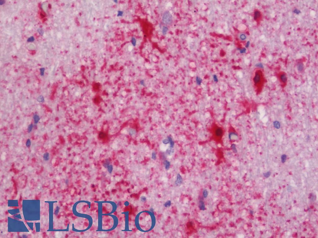 GJA1 / CX43 / Connexin 43 Antibody - Anti-GJA1 / CX43 / Connexin 43 antibody IHC staining of human brain, cortex. Immunohistochemistry of formalin-fixed, paraffin-embedded tissue after heat-induced antigen retrieval. Antibody dilution 1:200.