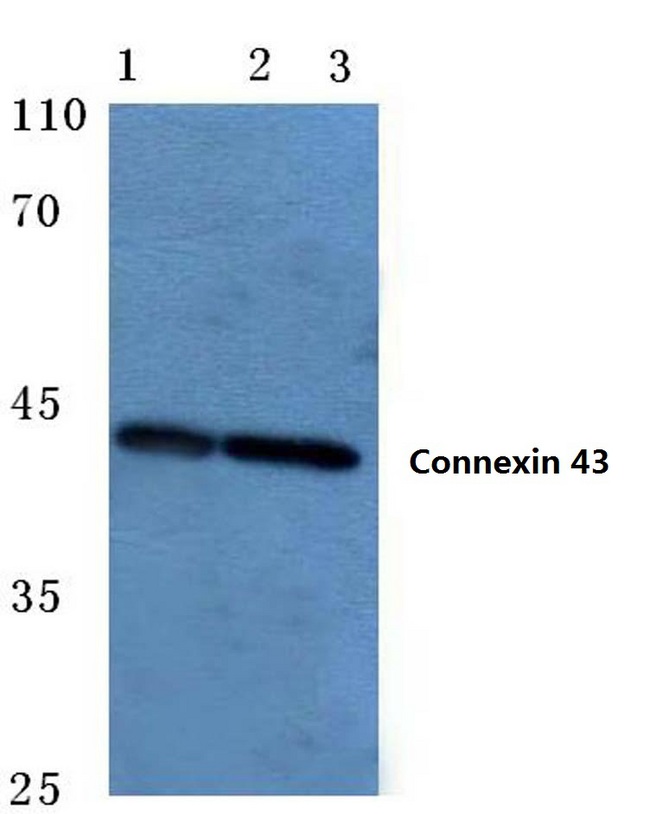 GJA1 / CX43 / Connexin 43 Antibody - Western blot analysis of Connexin 43 pAb at a 1:500 dilution. Lane 1: HEK293T cell lysate. Lane 2: Mouse heart tissue lysate. Lane 3: Rat brain tissue lysate.