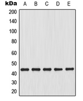GJA1 / CX43 / Connexin 43 Antibody - Western blot analysis of Connexin 43 expression in C6 (A); HeLa (B); C2C12 (C); mouse heart (D); rat brain (E) whole cell lysates.