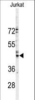 GJA3 / CX46 / Connexin 46 Antibody - Western blot of GJA3 Antibody in Jurkat cell line lysates (35 ug/lane). GJA3 (arrow) was detected using the purified antibody.