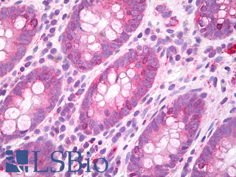 GJA3 / CX46 / Connexin 46 Antibody - Anti-GJA3 / Connexin 46 antibody IHC of human colon. Immunohistochemistry of formalin-fixed, paraffin-embedded tissue after heat-induced antigen retrieval. Antibody dilution 10 ug/ml.