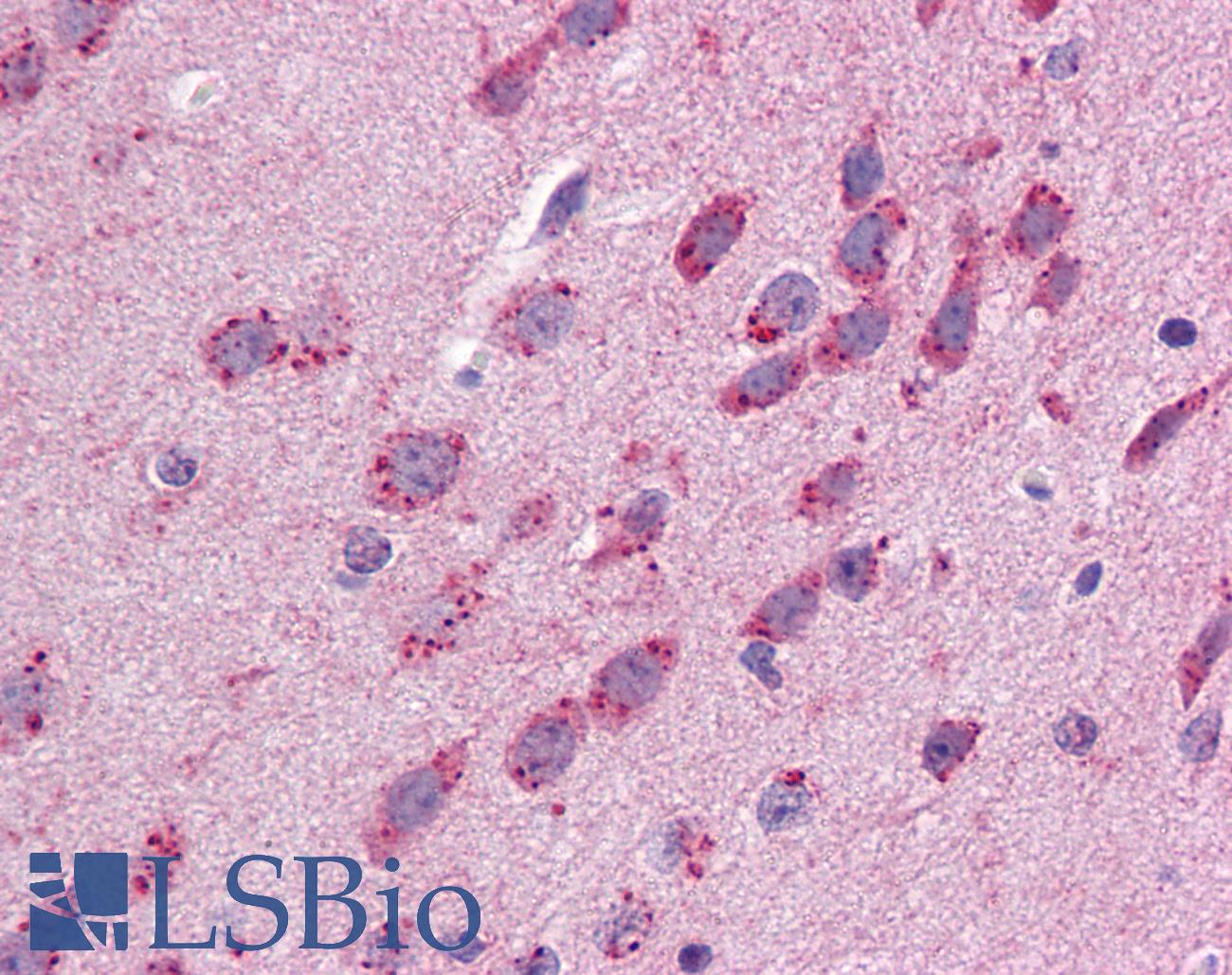 GJB3 / CX31 / Connexin 31 Antibody - Anti-GJB3 antibody IHC of mouse brain. Immunohistochemistry of formalin-fixed, paraffin-embedded tissue after heat-induced antigen retrieval. Antibody concentration 5 ug/ml.