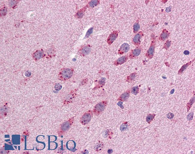 GJB3 / CX31 / Connexin 31 Antibody - Anti-GJB3 antibody IHC of mouse brain. Immunohistochemistry of formalin-fixed, paraffin-embedded tissue after heat-induced antigen retrieval. Antibody concentration 5 ug/ml.