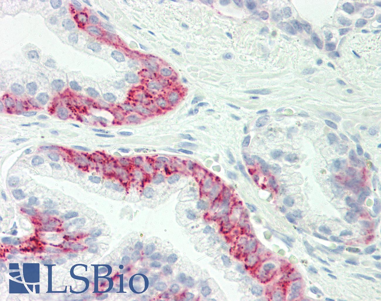 GJC1 / CX45 / Connexin 45 Antibody - Anti-GJC1 / CX45 / Connexin 45 antibody IHC staining of human prostate. Immunohistochemistry of formalin-fixed, paraffin-embedded tissue after heat-induced antigen retrieval. Antibody dilution 1:100.