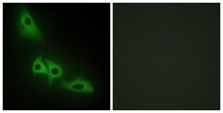 GK / Glycerol Kinase Antibody - Immunofluorescence analysis of HeLa cells, using GK Antibody. The picture on the right is blocked with the synthesized peptide.