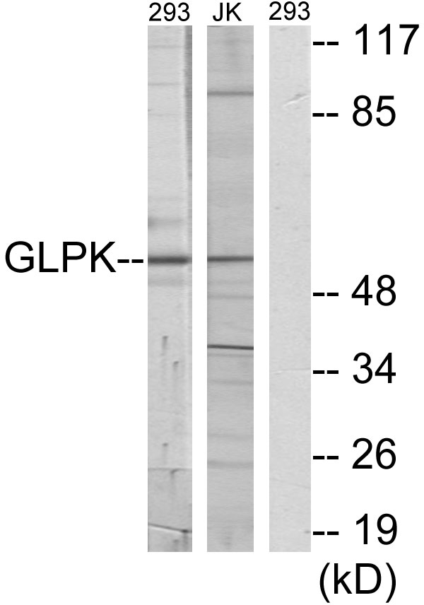 GK / Glycerol Kinase Antibody - Western blot analysis of lysates from 293 and Jurkat cells, using GK Antibody. The lane on the right is blocked with the synthesized peptide.