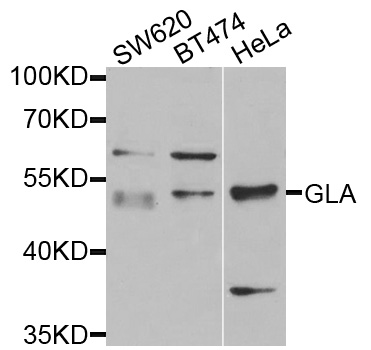 GLA / Alpha Galactosidase Antibody - Western blot analysis of extracts of various cell lines, using GLA antibody at 1:1000 dilution. The secondary antibody used was an HRP Goat Anti-Rabbit IgG (H+L) at 1:10000 dilution. Lysates were loaded 25ug per lane and 3% nonfat dry milk in TBST was used for blocking. An ECL Kit was used for detection and the exposure time was 30s.