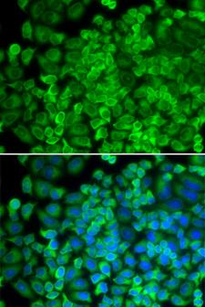 GLA / Alpha Galactosidase Antibody - Immunofluorescence analysis of HeLa cells using GLA antibody. Blue: DAPI for nuclear staining.