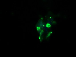 GLB1 / Beta-Galactosidase Antibody - Anti-GLB1 mouse monoclonal antibody immunofluorescent staining of COS7 cells transiently transfected by pCMV6-ENTRY GLB1.