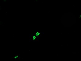 GLB1 / Beta-Galactosidase Antibody - Anti-GLB1 mouse monoclonal antibody immunofluorescent staining of COS7 cells transiently transfected by pCMV6-ENTRY GLB1.