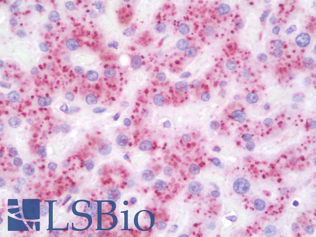 GLB1 / Beta-Galactosidase Antibody - Anti-GLB1 / Beta-Galactosidase antibody IHC staining of human liver. Immunohistochemistry of formalin-fixed, paraffin-embedded tissue after heat-induced antigen retrieval. Antibody concentration 10 ug/ml.