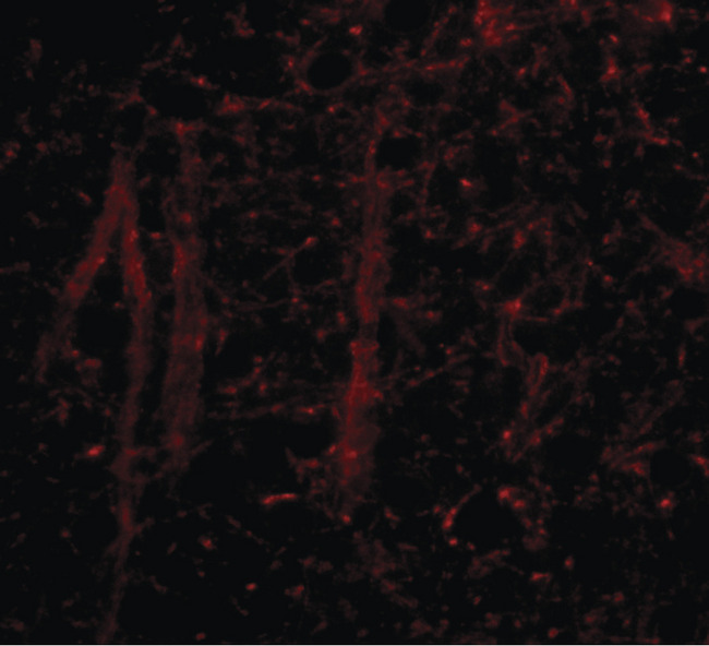 GLE1 Antibody - Immunofluorescence of gle1 in mouse brain tissue with gle1 antibody at 20 ug/ml.