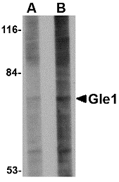 GLE1 Antibody - Western blot of Gle1 in 293 cell lysate with Gle1 antibody at (A) 1 and (B) 2 ug/ml.