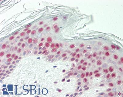 GLI / GLI1 Antibody - Human Skin: Formalin-Fixed, Paraffin-Embedded (FFPE)